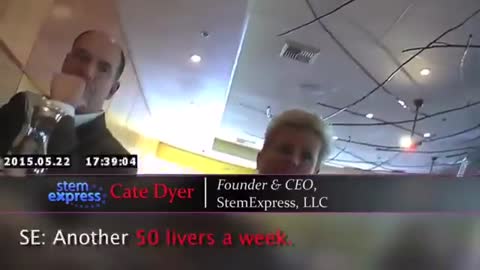 abortion parts, economic plan