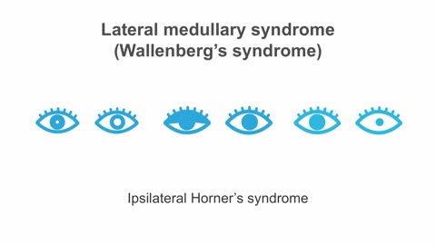 Clinical Neurology Essentials 2.Mastering the pons and medulla