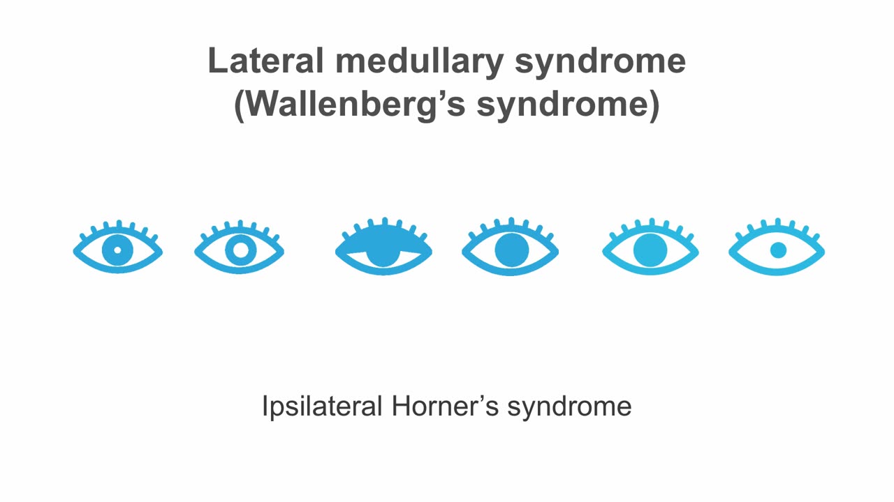 Clinical Neurology Essentials 2.Mastering the pons and medulla