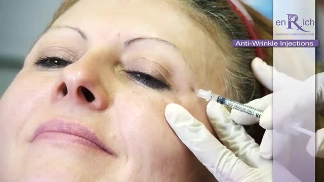 Remove Wrinkles with Anti-Wrinkle Injections at enRich Clinic