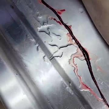 Abnormal blood clots being removed
