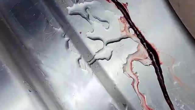 Abnormal blood clots being removed