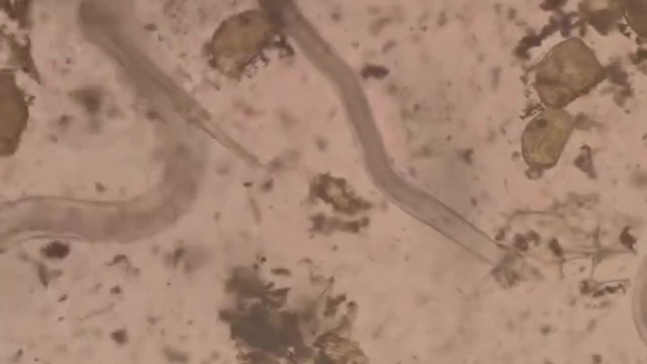 Tumeric Super Root vs. Human Parasites