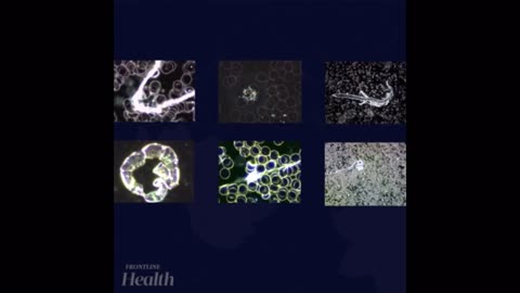 Vaccine: what they found in them