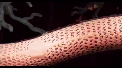 What Graphene Oxide might do to the body.