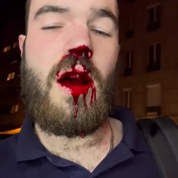 French journalist at a #JusticeForLola protest and vigil tonight attacked by Antifa!