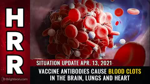 04-13-21 S.U. - Vaccine Antibodies CAUSE Blood Clots in the Brain Lungs and Heart