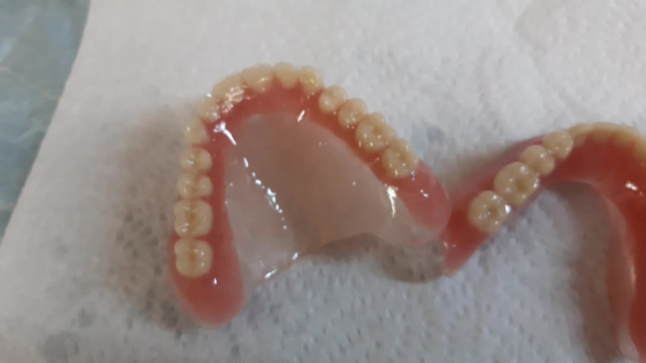 dental prosthesis