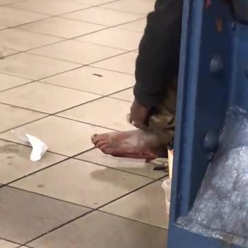 Person scratching ashy foot subway station