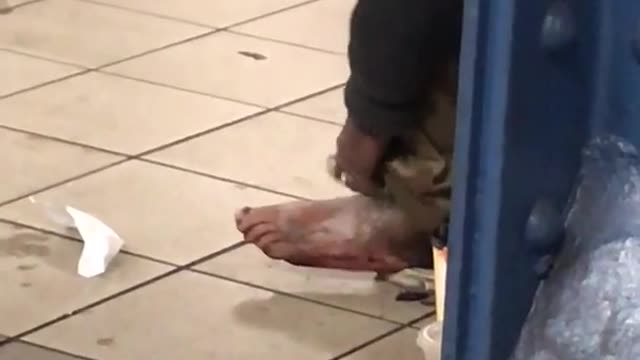 Person scratching ashy foot subway station
