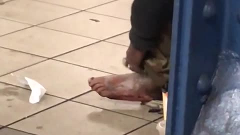 Person scratching ashy foot subway station