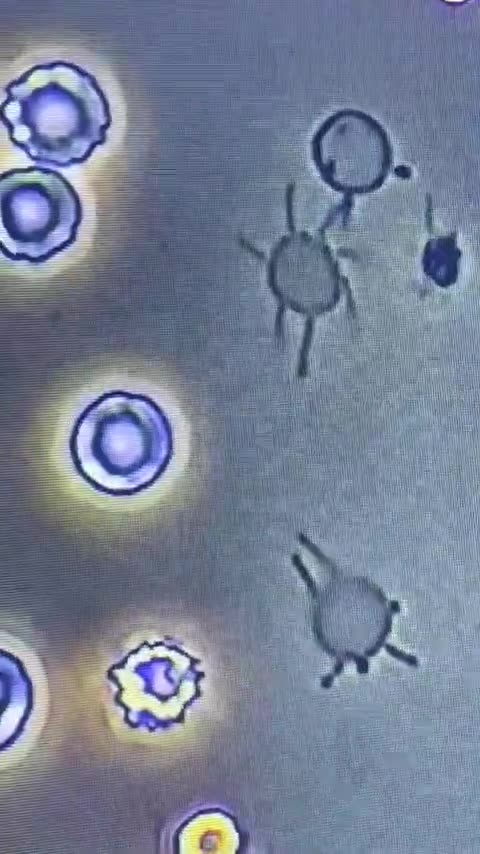 pHase Contrast Microscopy Reveals Vesicles of Protein Spiking OUT of the Red Blood Cells