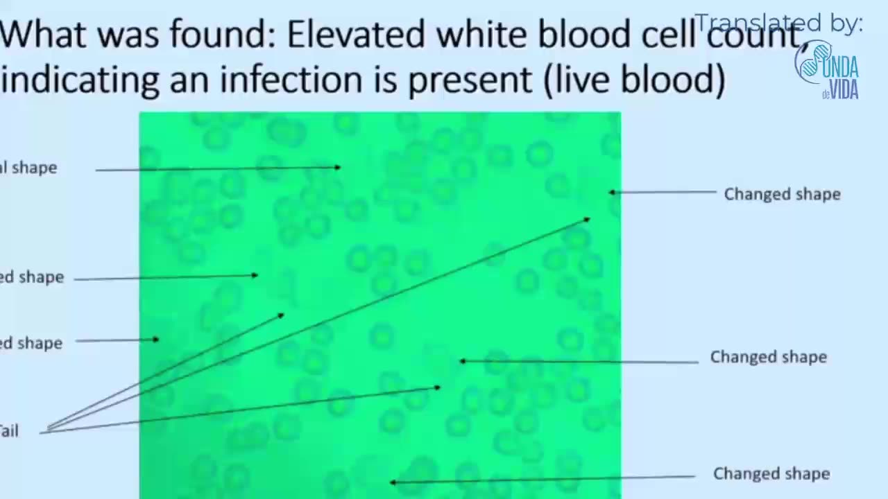 David Schmidt talks about the adverse effects of C19 vaccines (translated in 15 Subtitles)