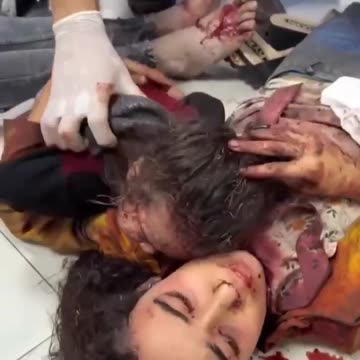 😔⚠️ GAZA, DOPO IL BOMBARDAMENTO DELL'OSPEDALE‼️😔