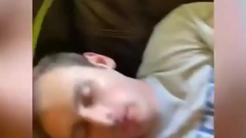 an egg on the forehead