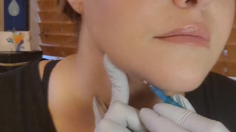 Under Chin tightening w/ cog's