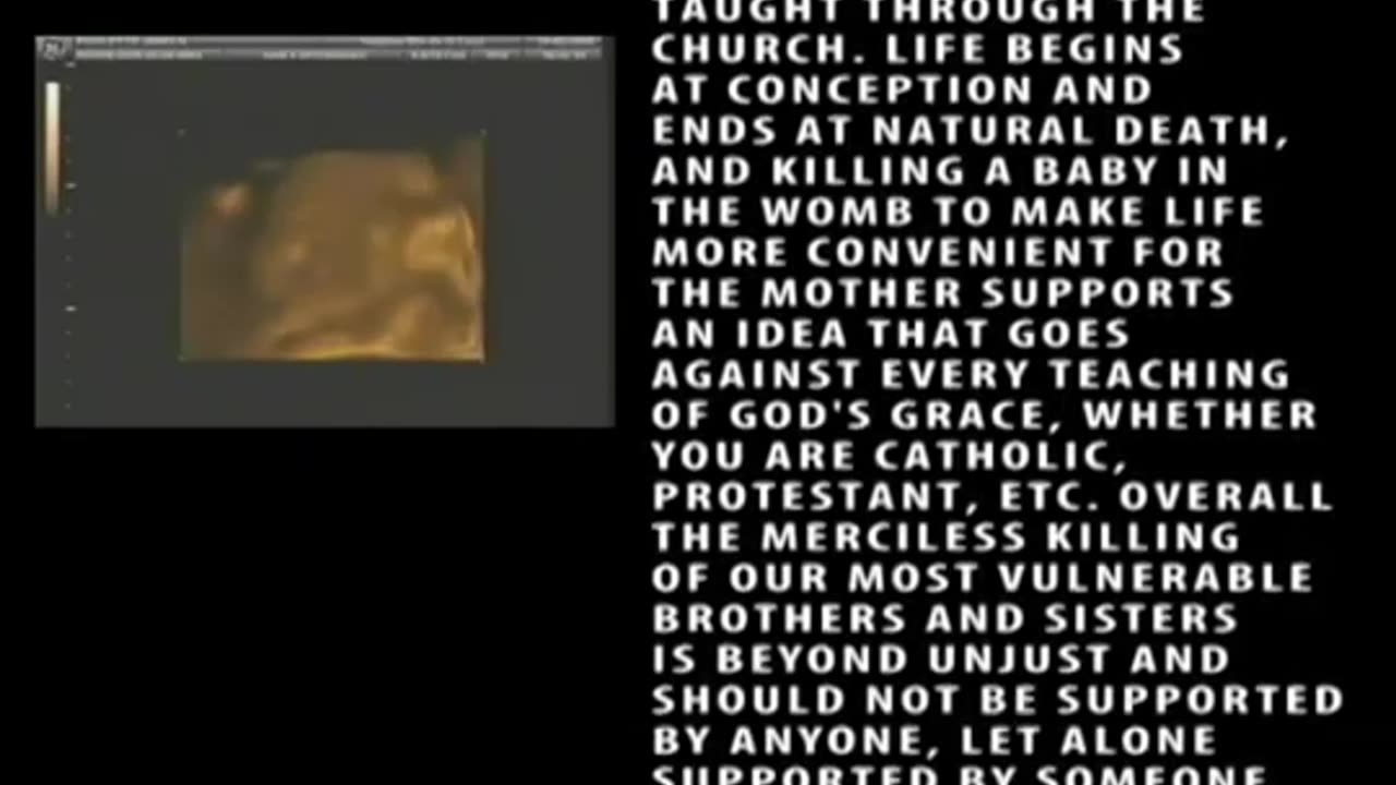 You Cannot Be A Christian and Pro Choice