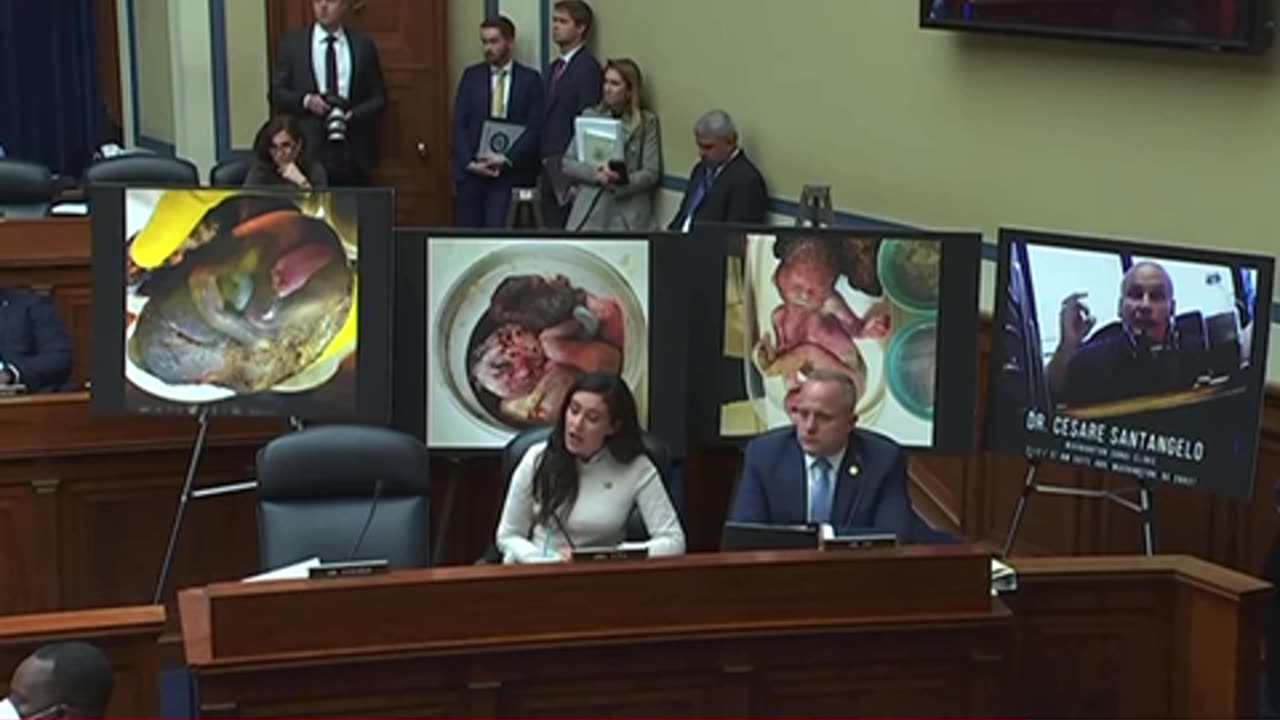 *WARNING GRAPHIC* - REP. LUNA ADDRESSING THE CRIMINALITY OF LATE TERM ABORTION