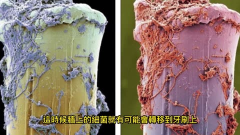洗澡時別刷牙 細菌都進口腔