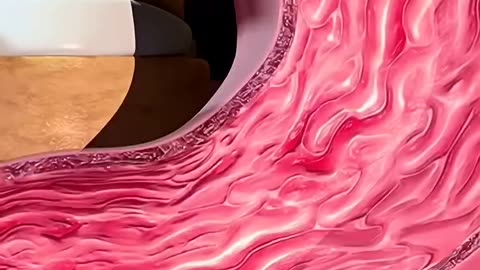 Peptic Ulcer 😮‍💨