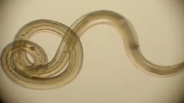 Parasites info... warning, this may inspire a cleanse.