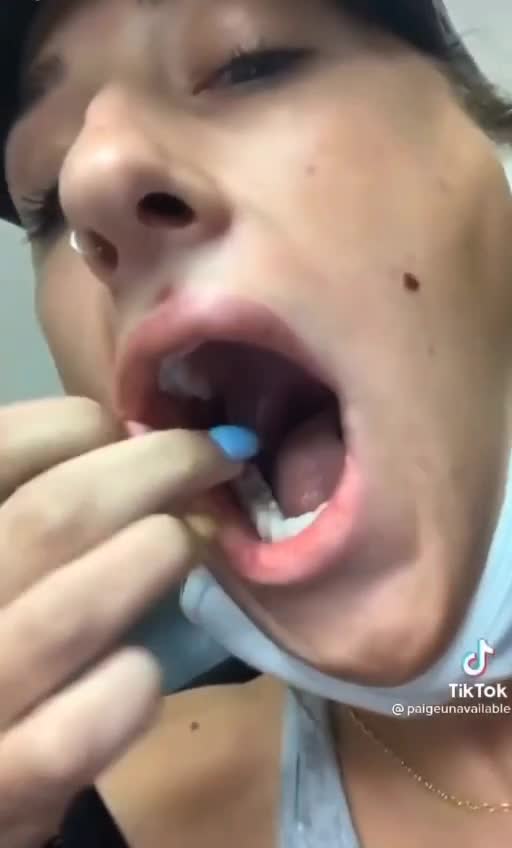 vaxx injured mouth and face sores