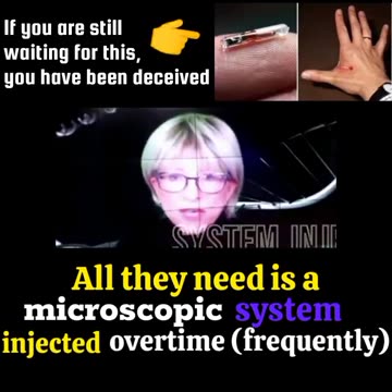 "They don't need a CHIP?"