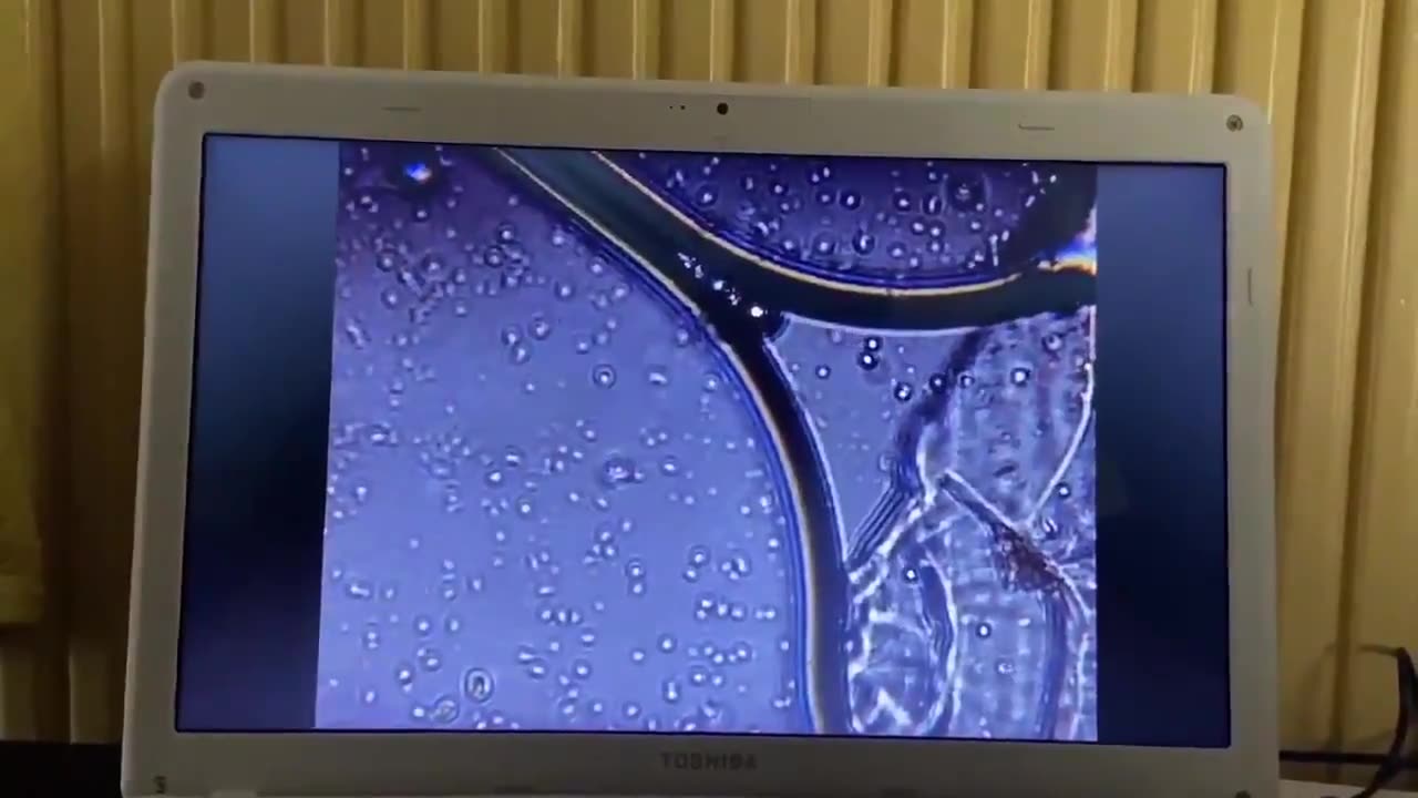 This is the fyzer modified injection.