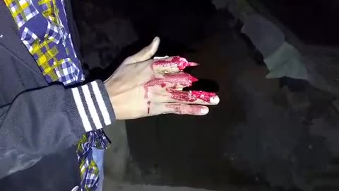 Finger cut demo