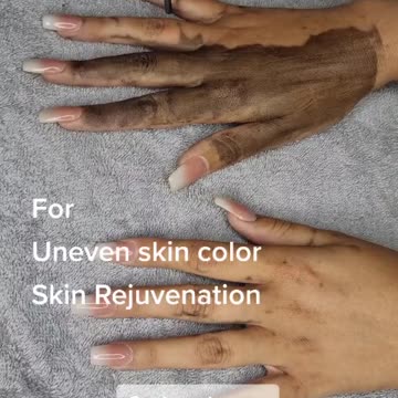 To achieve your ideal weight