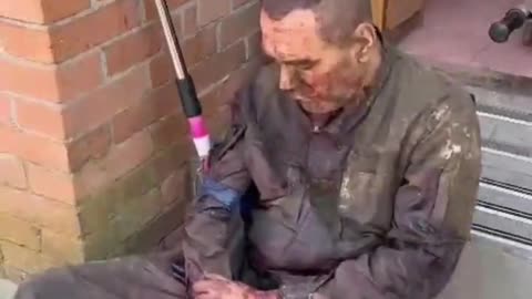 Slaughter near Orekhov and Russian forces Treating wounded Ukrainian soldiers