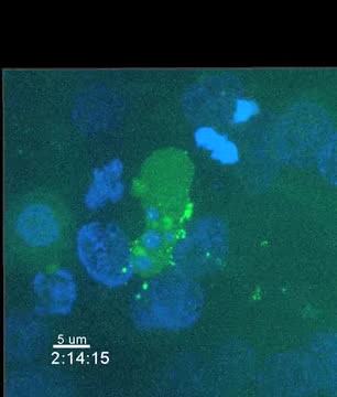 HIV-1 Infected Cell sheds exosomes