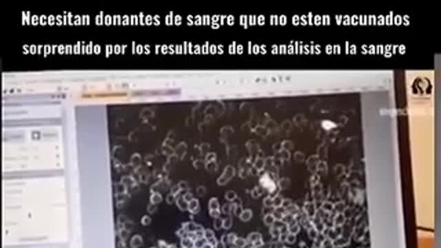 VACUNADOS DEBEN URGENTEMENTE REALIZARSE UNA PRUEBA DE SANDRE DE DIMERO D , SI ES QUE DESEAN SALVAR SUS VIDAS Y PRESENTAMOS COMPARACION DE SANGRE DE VACUNADOS Y NO VACUNADOS