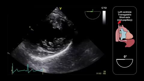 07. Transgastric views