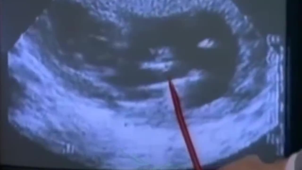 Sobre o aborto