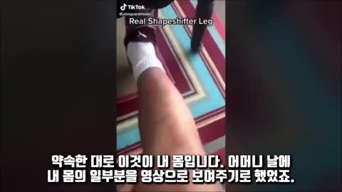 접종현상(유전자 몸의 변화)