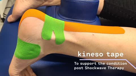 Plantar Fasciitis – Shockwave Therapy