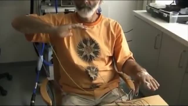 Functional Tremor - Springer