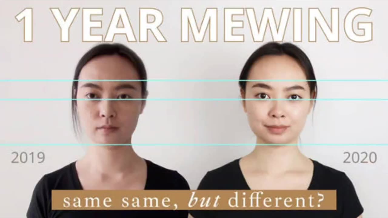 **crazy** MEWING TRANSFORMATION !