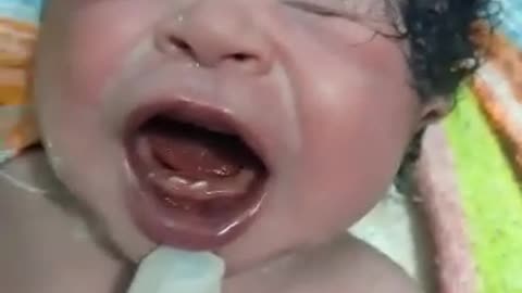 Baby deliverd by teeth