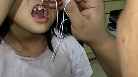 Teeth pulling out