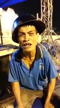 The man with the world's funniest teeth