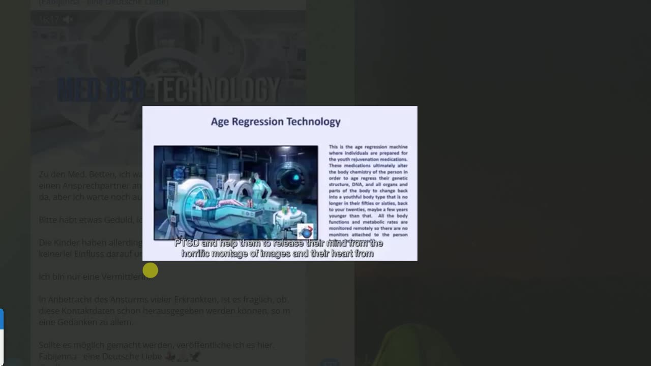 这个视频里面的事情是真的。med bed technology