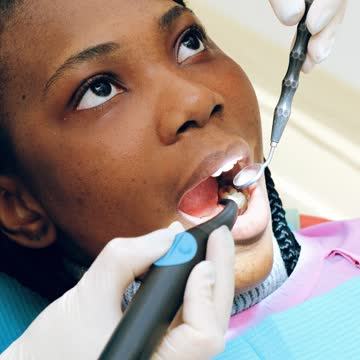 5 reasons why tongue cleaning is important