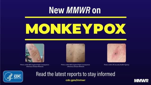 Severe Monkeypox in Hospitalized Patients — United States, August 10–October 10, 2022