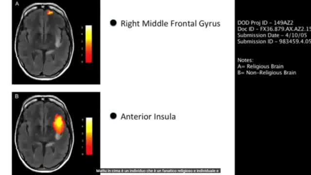 Discussione di un progetto per modificare il comportamento umano tramite l'uso di vaccini