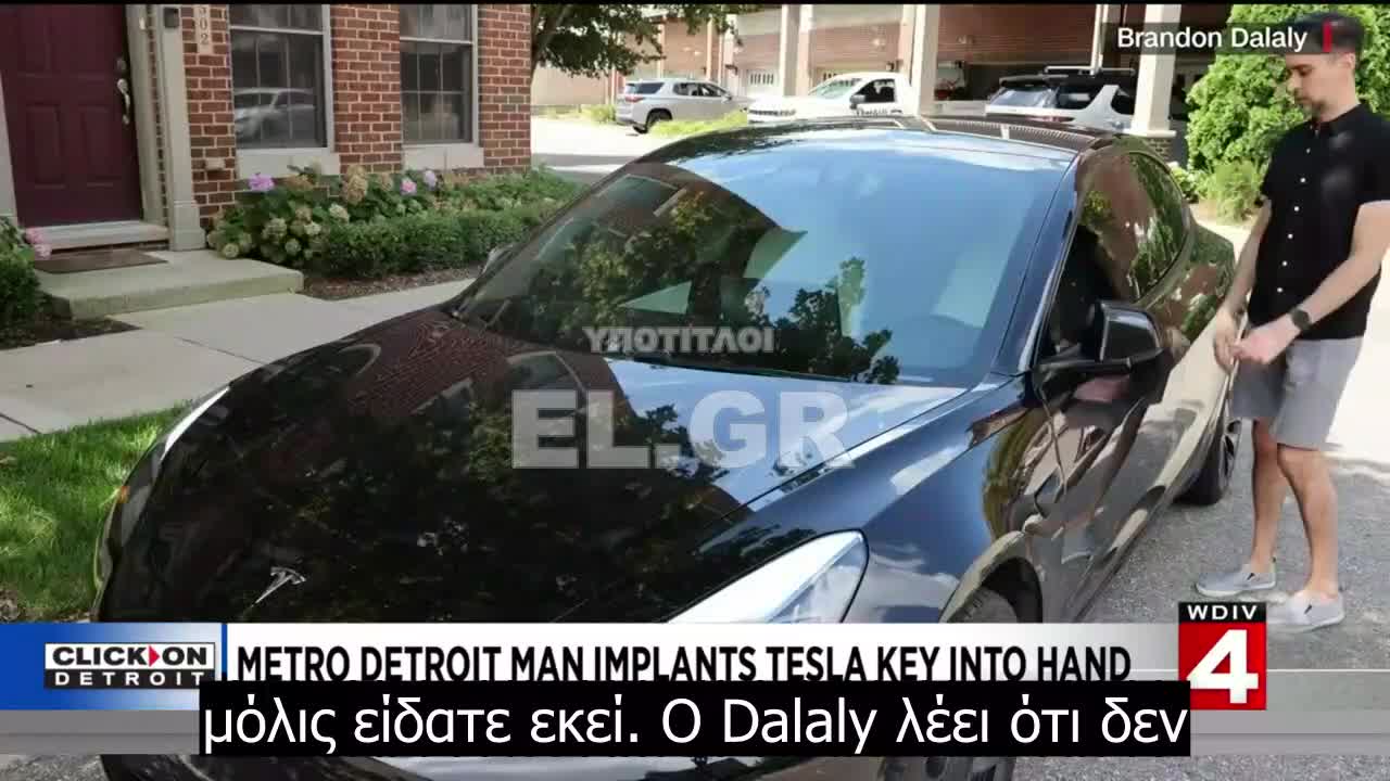 Άνδρας από το Μετρο-Ντιτρόιτ εμφυτεύει το κλειδί του αυτοκινήτου Tesla στο χέρι του