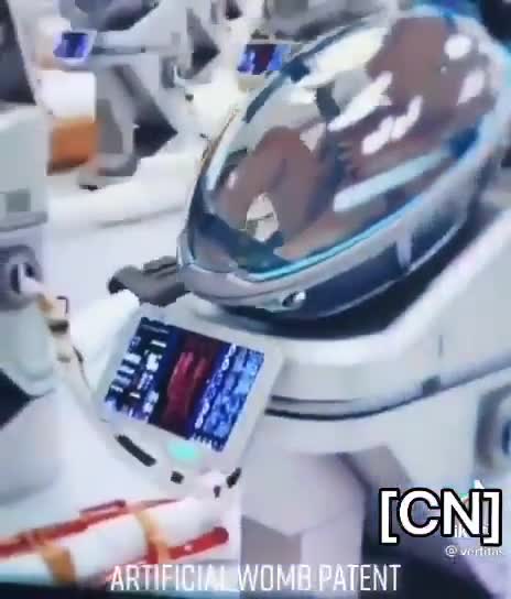 The Netherlands 🧐