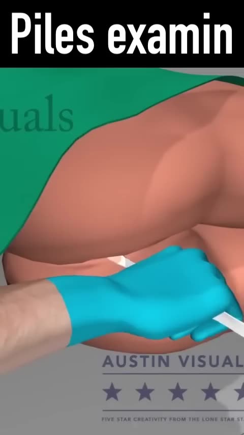 3D Animation For Piles Examination