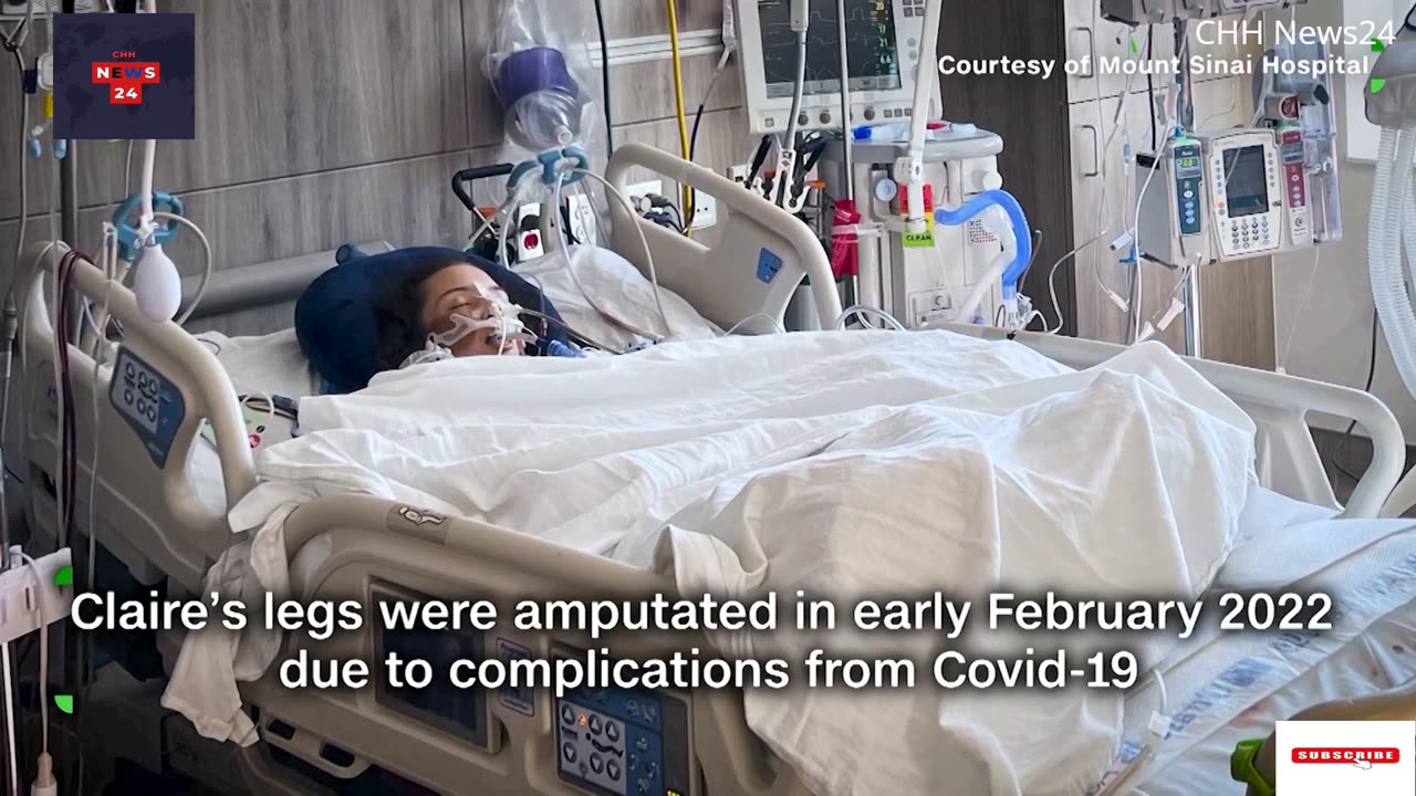 21-year-old model becomes double-amputee after severe illness/CHH News24